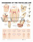 Disorders of the Teeth and Jaw Anatomical Chart